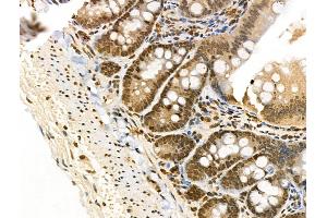 anti-Peptidyl Prolyl Cis/Trans Isomerase NIMA Interacting 4 Protein (PIN4) (pTyr122) antibody