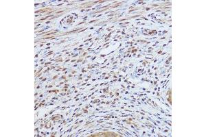 Immunohistochemistry of paraffin-embedded mouse uterus using GLI1 Rabbit pAb (ABIN7271533) at dilution of 1:150 (40x lens). (GLI1 antibody  (AA 200-300))