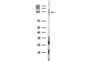 anti-phosphodiesterase 6B, CGMP-Specific, Rod, beta (PDE6B) (N-Term) antibody