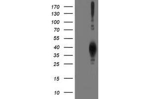 HEK293T cells were transfected with the pCMV6-ENTRY control (Left lane) or pCMV6-ENTRY LCMT1 (Right lane) cDNA for 48 hrs and lysed. (LCMT1 antibody)