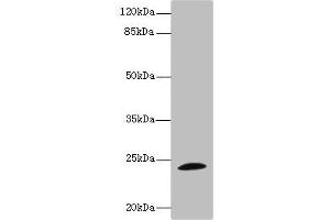 Western blot All lanes: TPPP antibody IgG at 1. (Tppp antibody  (AA 1-219))