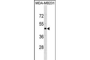CCR5 Antibody (Center) (ABIN1881182 and ABIN2838678) western blot analysis in MDA-M cell line lysates (35 μg/lane).