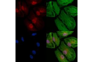 ABIN6257088 and ABIN6273791 staining  cells by IF/ICC. (CSNK2A2 antibody  (N-Term))