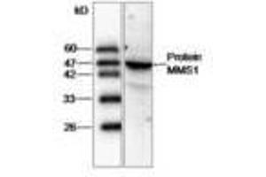 Image no. 1 for anti-Proteasome (Prosome, Macropain) 26S Subunit, ATPase, 2 (PSMC2) antibody (ABIN791429) (PSMC2 antibody)