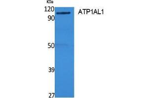 Western Blotting (WB) image for anti-ATPase, H+/K+ Transporting, Nongastric, alpha Polypeptide (ATP12A) (Internal Region) antibody (ABIN3178130) (ATP12A antibody  (Internal Region))