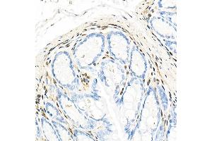 Immunohistochemistry (IHC) image for anti-Protein Quaking (QKI) antibody (ABIN7269699)