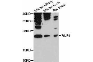 Western blot analysis of extracts of various cell lines, using RNF4 antibody (ABIN6291207) at 1:3000 dilution. (RNF4 antibody)