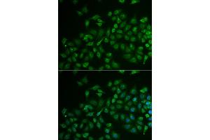 Immunofluorescence analysis of U2OS cells using MPP2 antibody (ABIN5974010).