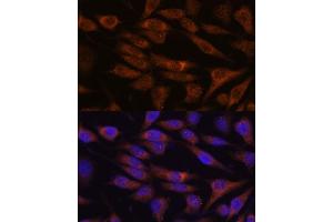Immunofluorescence analysis of L929 cells using UNC13B antibody (ABIN7271215) at dilution of 1:100. (UNC13B antibody  (AA 1-350))