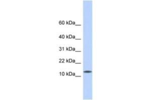 Western Blotting (WB) image for anti-CMT1A Duplicated Region Transcript 4 (CDRT4) antibody (ABIN2463940) (CDRT4 antibody)