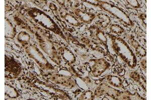 ABIN6273110 at 1/100 staining Human kidney tissue by IHC-P. (DHX9 antibody  (C-Term))