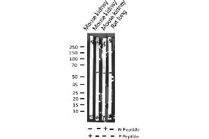 Western Blotting (WB) image for anti-Myocyte Enhancer Factor 2A (MEF2A) (pThr319) antibody (ABIN6255667)