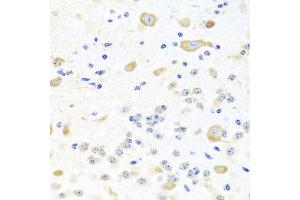 Immunohistochemistry of paraffin-embedded mouse brain using INPP5K antibody at dilution of 1:100 (x40 lens). (INPP5K antibody)