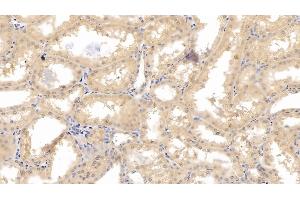 Immunohistochemistry (IHC) image for anti-Hypoxia Inducible Factor 1, alpha Subunit (Basic Helix-Loop-Helix Transcription Factor) (HIF1A) (AA 575-826) antibody (ABIN7428677)