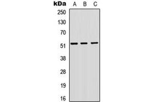 Western blot analysis of VIPR1 expression in A549 (A), H9C2 (B), Raw264.
