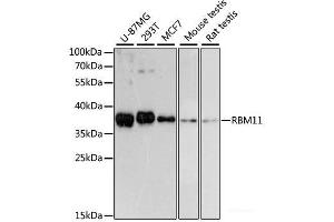 Western blot analysis of extracts of various cell lines using RBM11 Polyclonal Antibody at dilution of 1:3000. (RBM11 antibody)