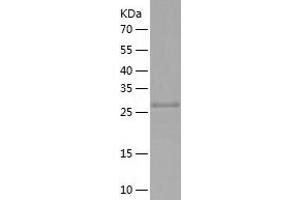 Western Blotting (WB) image for NLR Family, CARD Domain Containing 4 (NLRC4) (AA 764-1019) protein (His tag) (ABIN7288975) (NLRC4 Protein (AA 764-1019) (His tag))