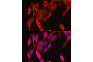 Immunofluorescence analysis of PC-12 cells using Vinculin antibody (ABIN6128911, ABIN6150070, ABIN6150071 and ABIN6218474) at dilution of 1:150. (Vinculin antibody  (AA 767-1066))