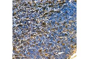 Immunohistochemistry (Paraffin-embedded Sections) (IHC (p)) image for anti-Linker For Activation of T Cells (LAT) antibody (ABIN7074502)