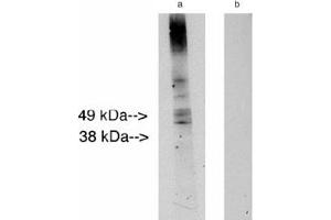 Image no. 1 for anti-Ceramide Synthase 2 (CERS2) antibody (ABIN265218) (Ceramide Synthase 2 antibody)