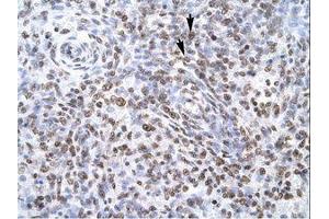 Image no. 1 for anti-Zinc Finger Protein 500 (ZNF500) (AA 348-397) antibody (ABIN6735775) (ZNF500 antibody  (AA 348-397))