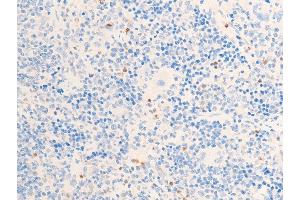 Immunohistochemistry (IHC) image for anti-Checkpoint Kinase 1 (CHEK1) (pSer317) antibody (ABIN6255201)