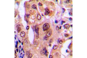 Immunohistochemistry (IHC) image for anti-Nucleophosmin (Nucleolar phosphoprotein B23, Numatrin) (NPM1) (N-Term) antibody (ABIN7296470)