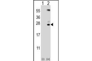 Western blot analysis of KLK6 (arrow) using rabbit polyclonal KLK6 Antibody (A13) (ABIN652195 and ABIN2840741).
