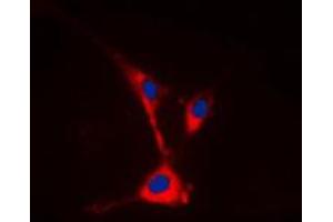 Immunofluorescent analysis of TUSC3 staining in HeLa cells. (TUSC3 antibody  (Center))
