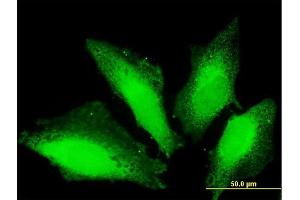 Immunofluorescence of purified MaxPab antibody to TTC15 on HeLa cell. (TTC15 antibody  (AA 1-735))