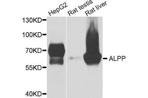 Western blot analysis of extracts of various cell lines, using ALPP antibody (ABIN5975263) at 1/1000 dilution. (PLAP antibody)