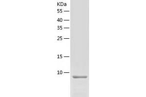 Western Blotting (WB) image for Chemokine (C-C Motif) Ligand 8 (CCL8) (AA 24-99) protein (His tag) (ABIN7286813) (CCL8 Protein (AA 24-99) (His tag))