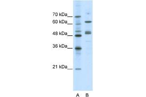 WB Suggested Anti-GATA4 Antibody Titration:  0.