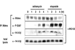 Western Blotting (WB) image for anti-Mdm4-binding Protein (MDM4) (pSer367) antibody (ABIN3201009)