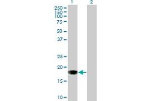 Western Blot analysis of SNX20 expression in transfected 293T cell line by SNX20 MaxPab polyclonal antibody. (SNX20 antibody  (AA 1-129))