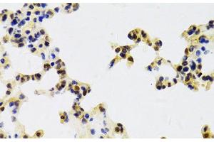 Immunohistochemistry of paraffin-embedded Mouse lung using HDGF Polyclonal Antibody at dilution of 1:100 (40x lens).