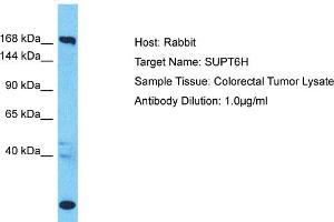 Host: Rabbit Target Name: SUPT6H Sample Type: Colorectal Tumor lysates Antibody Dilution: 1.