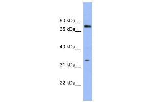 WB Suggested Anti-PATZ1 Antibody Titration:  0. (PATZ1 antibody  (N-Term))