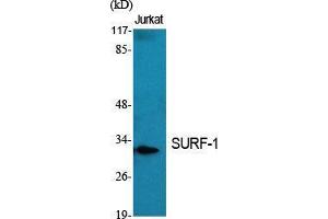 Western Blot (WB) analysis of specific cells using SURF-1 Polyclonal Antibody.
