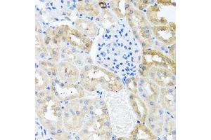 Immunohistochemistry of paraffin-embedded rat kidney using MYLK antibody at dilution of 1:100 (x40 lens). (MYLK antibody)