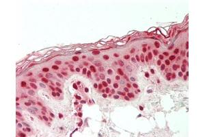 Human Skin: Formalin-Fixed, Paraffin-Embedded (FFPE). (DDX39B antibody  (Biotin))
