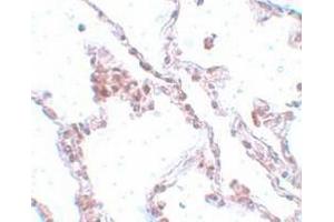 Immunohistochemistry staining of human lung tissue (Paraffin section) using TMEM184B Antibody  at 5 μg/ml. (TMEM184B antibody  (C-Term))
