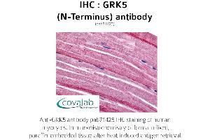 Image no. 1 for anti-G Protein-Coupled Receptor Kinase 5 (GRK5) (N-Term) antibody (ABIN1735256) (GRK5 antibody  (N-Term))
