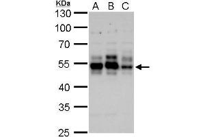 WB Image Tau antibody detects Tau protein by Western blot analysis. (MAPT antibody)