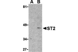 Western Blotting (WB) image for anti-Interleukin 1 Receptor-Like 1 (IL1RL1) (N-Term) antibody (ABIN1031587) (IL1RL1 antibody  (N-Term))