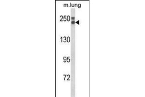Western blot analysis of COL18A1 Antibody (N-term) (ABIN652798 and ABIN2842523) in mouse lung tissue lysates (35 μg/lane). (COL18A1 antibody  (N-Term))