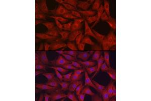Immunofluorescence analysis of NIH/3T3 cells using GPX4 Rabbit pAb (ABIN3015729, ABIN3015730, ABIN3015731, ABIN1680090 and ABIN6219078) at dilution of 1:200 (40x lens).