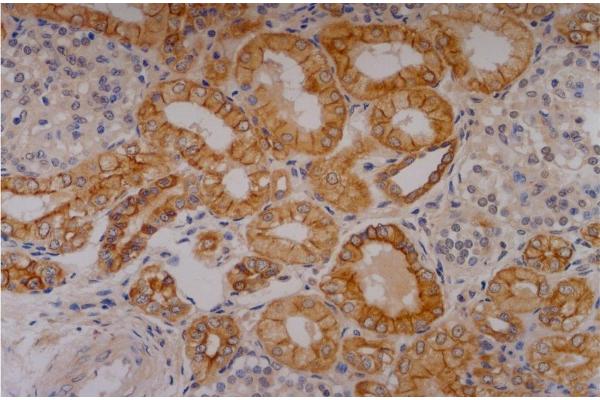 Cytokeratin 18 antibody