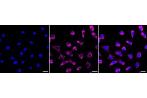 Immunocytochemical staining of Hela cells with HAPLN1 antibody (ABIN7799008), 1:1,000). (Recombinant HAPLN1 antibody)