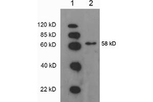 Western blot analysis: Lane 1: EasyWestern Protein Standard   Lane 2. (ATP6V1B2 antibody)